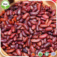 Red Speckled Kidney Bean (2016 Ernte, Heilongjiang Herkunft, HPS)
